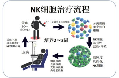 NK细胞疗法流程图.png